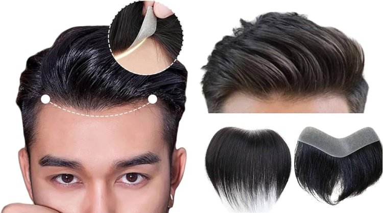 Things You Didn't Know About Hair systems for men