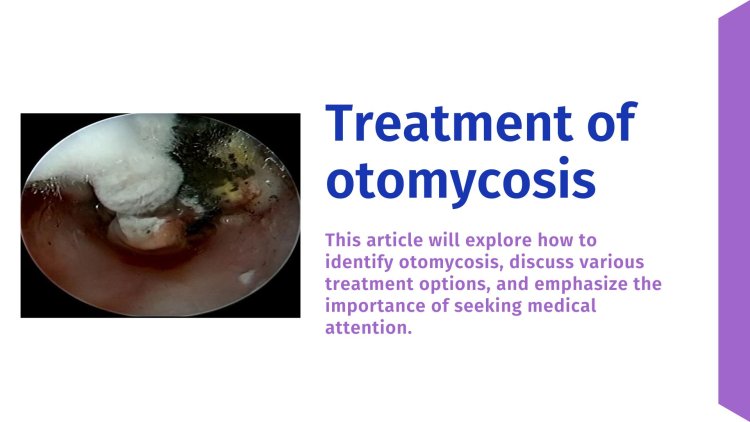 Effective Treatments for Otomycosis: Managing Fungal Ear Infections
