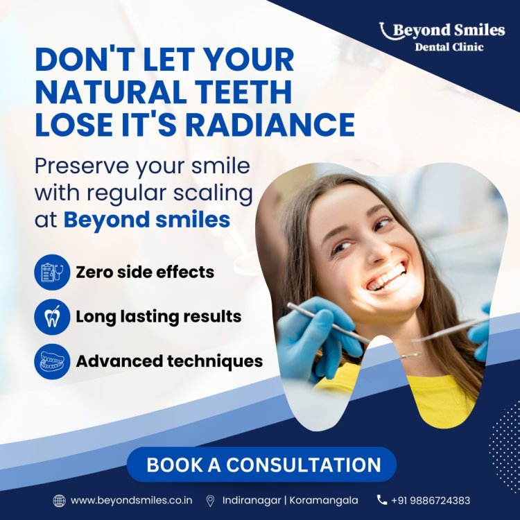 Discover the Best Dental Clinic in Bangalore, Indiranagar
