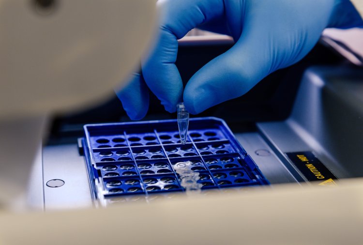 Cell Based Assays Market Research Report 2024-2033: Key Drivers, Insights, Outlook, and Overview