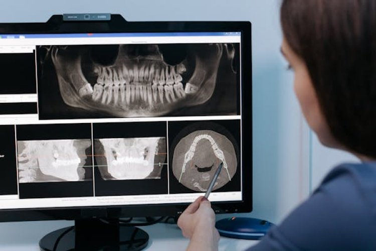 Dental X-Ray Equipment Global Market 2024 - By Share, Growth, Demand, Trends, Forecast To 2033