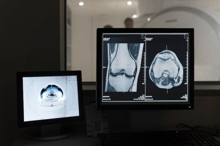 Digital X-Ray Devices Market Research Analysis 2024-2033 | Growth, Size, Analysis, Insights