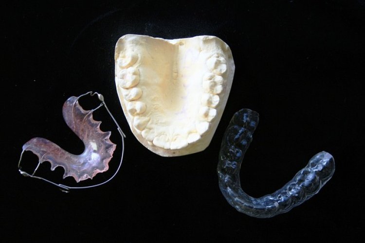 Invisible Orthodontics Global Market Predicted to Augment and Reach over $9.47 Billion at a CAGR of 15.3% By 2028