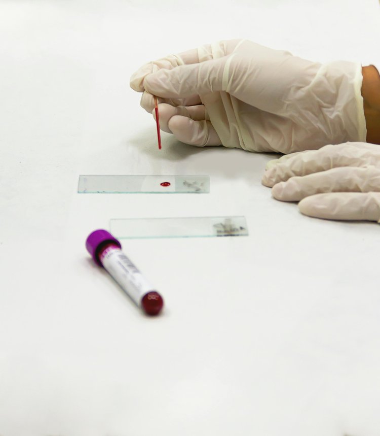Immunoglobulin E (IgE) Allergy Blood Tests Market Expansion 2024-2033