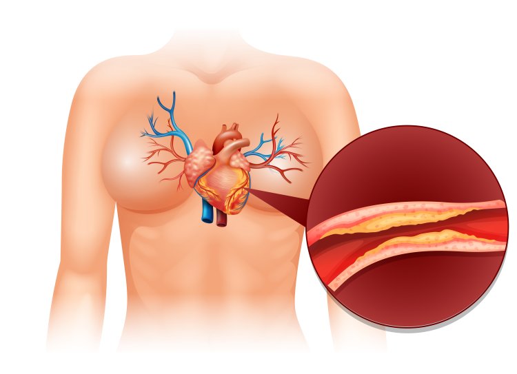 Self-Expanding Stents Market Key Drivers, Analysis, Trends, Overview And Forecast To 2033