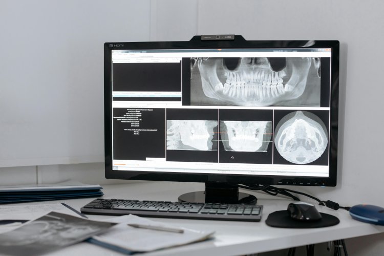 Dental Digital X-Ray Market Size, Share Analysis, Trends, Growth Revenue 2033