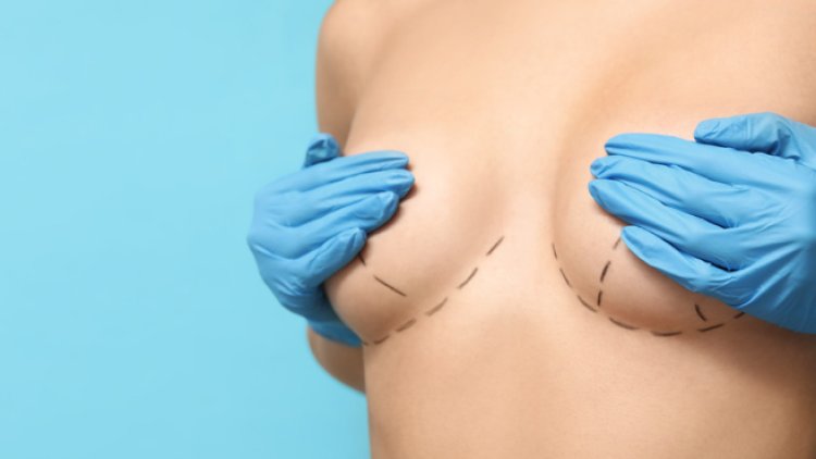 Breast Lift Plastic Surgery: Restoring Youthful Contours