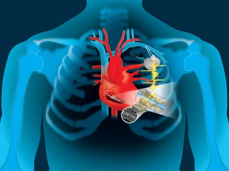 Cardiovascular Implants Market Opportunities, Size, Share, and Analysis 2024-2033