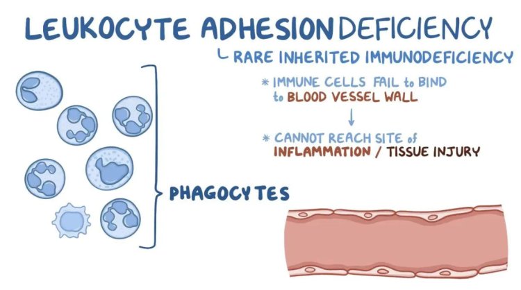 Leukocyte Adhesion Deficiency Management Market Size, Insights Forecast, Growth, Trends 2024-2033