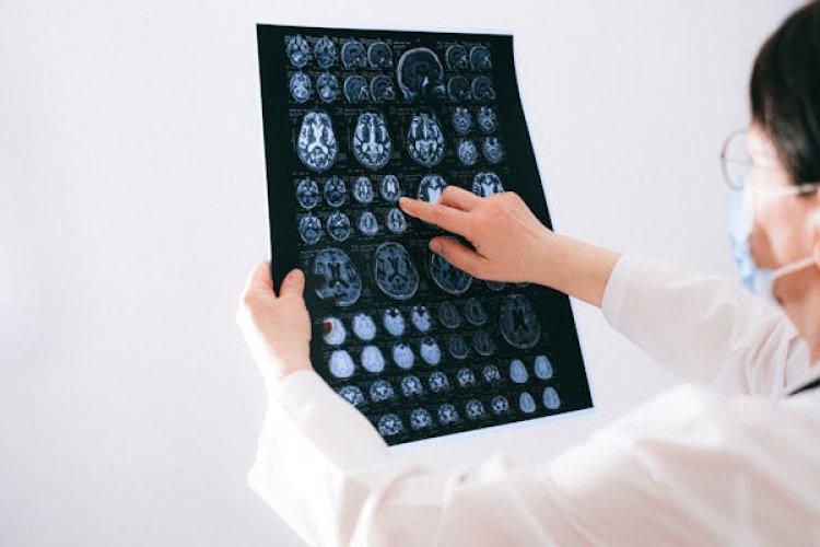 Traumatic Brain Injuries Assessment And Management Devices Market 2024 - By Key Players, Regional Overview, Opportunities, Challenges And Outlook By 2033