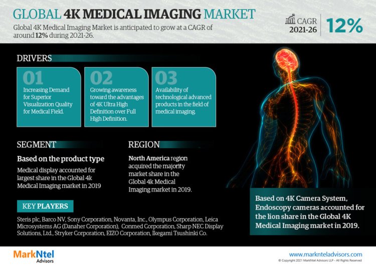 4K Medical Imaging Market Bifurcations, Drivers, Restraints, And Trends for 2021-2026