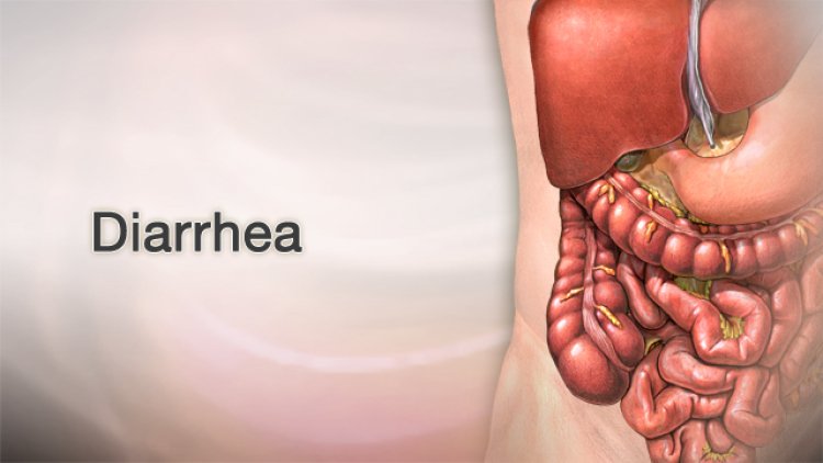 How to Control Diarrhea?