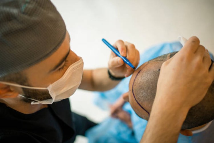 What Makes Hair Transplant in Riyadh Different: Innovative Approaches Explained