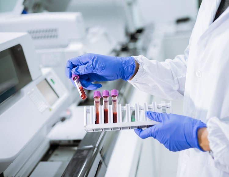 Hematology Analyzers Market Size, Share, In-Depth Insights and Forecast 2024-2032