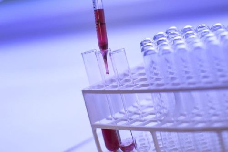 Global High Throughput Screening (HTS) Market Overview 2024: Size, Growth Rate, and Segments