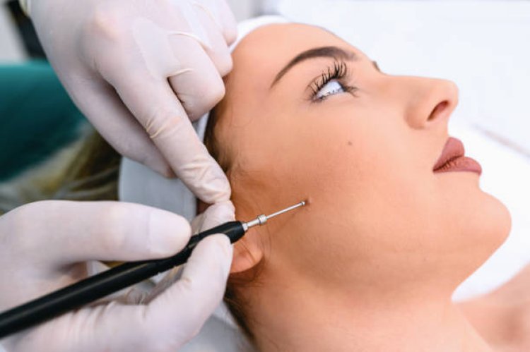 Finding Affordable Mole Removal Services in Abu Dhabi