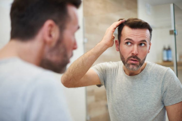 Affordable Hair Loss Treatments in Abu Dhabi