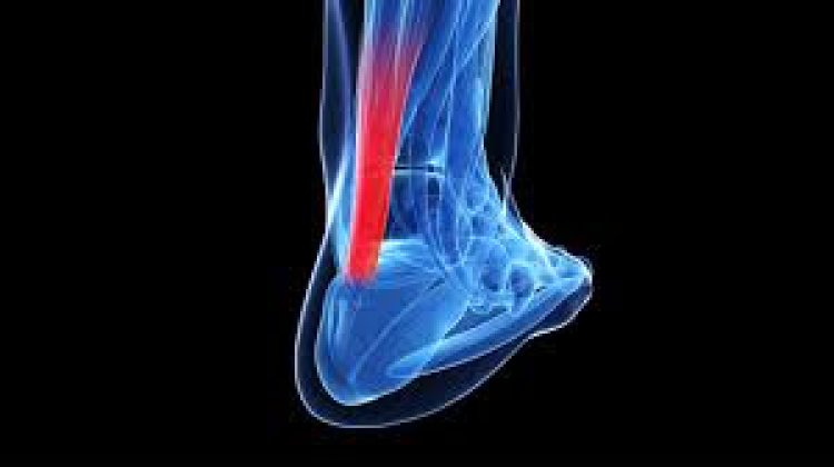 Achilles Tendonitis Treatment Center