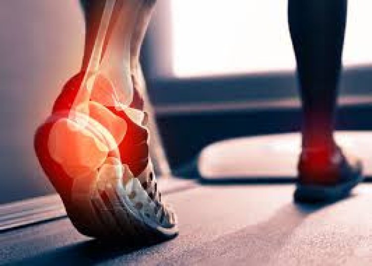 Achilles Tendonitis Treatment Center