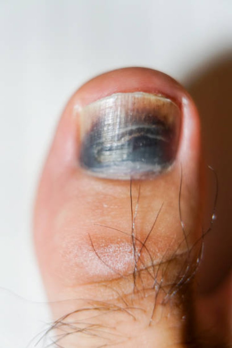 Comprehensive Guide to Nail Disorders Care in Abu Dhabi