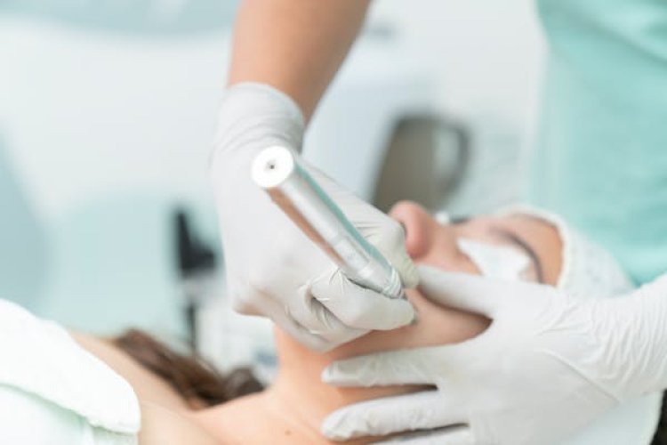 Dermatology Medical Lasers Global Market Report 2024 - By Share, Growth, Demand, Trends, Forecast To 2033