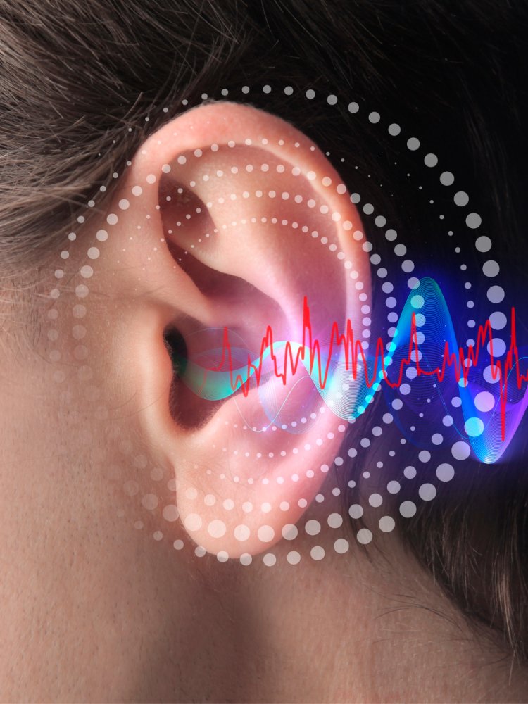 Hearing Implants Market Key Insights, Share And Growth Forecast 2024-2033