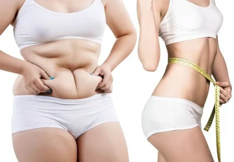 How to Stay Motivated After Liposuction