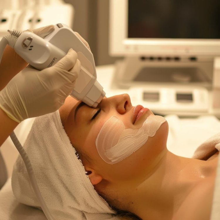 Why Chemical Peels Are Essential for Skin Renewal