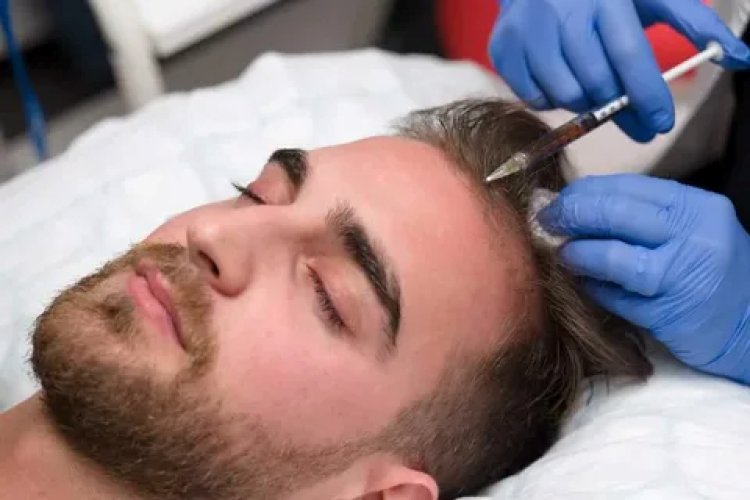 What to Know Before Getting Plasma Injections for Hair