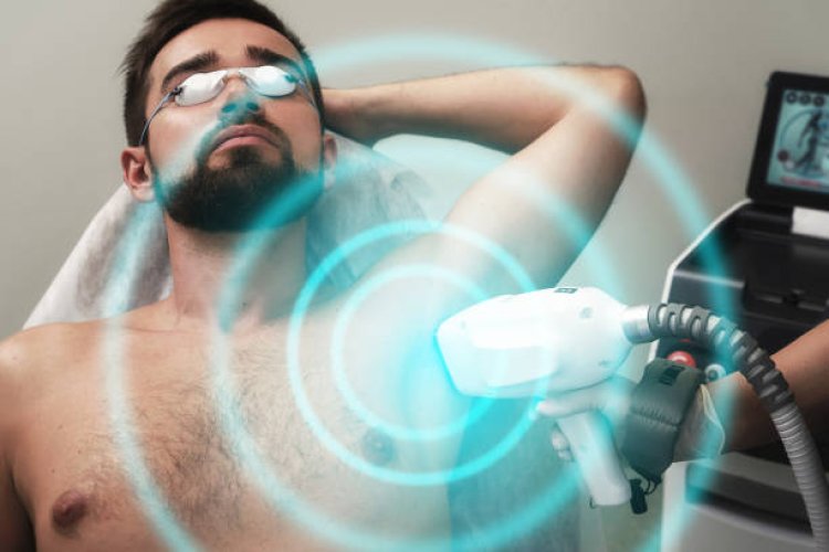 Painless and Quick Men’s Laser Hair Removal