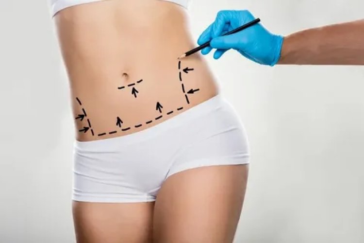 Your Liposuction Journey: From Consultation to Recovery in Abu Dhabi