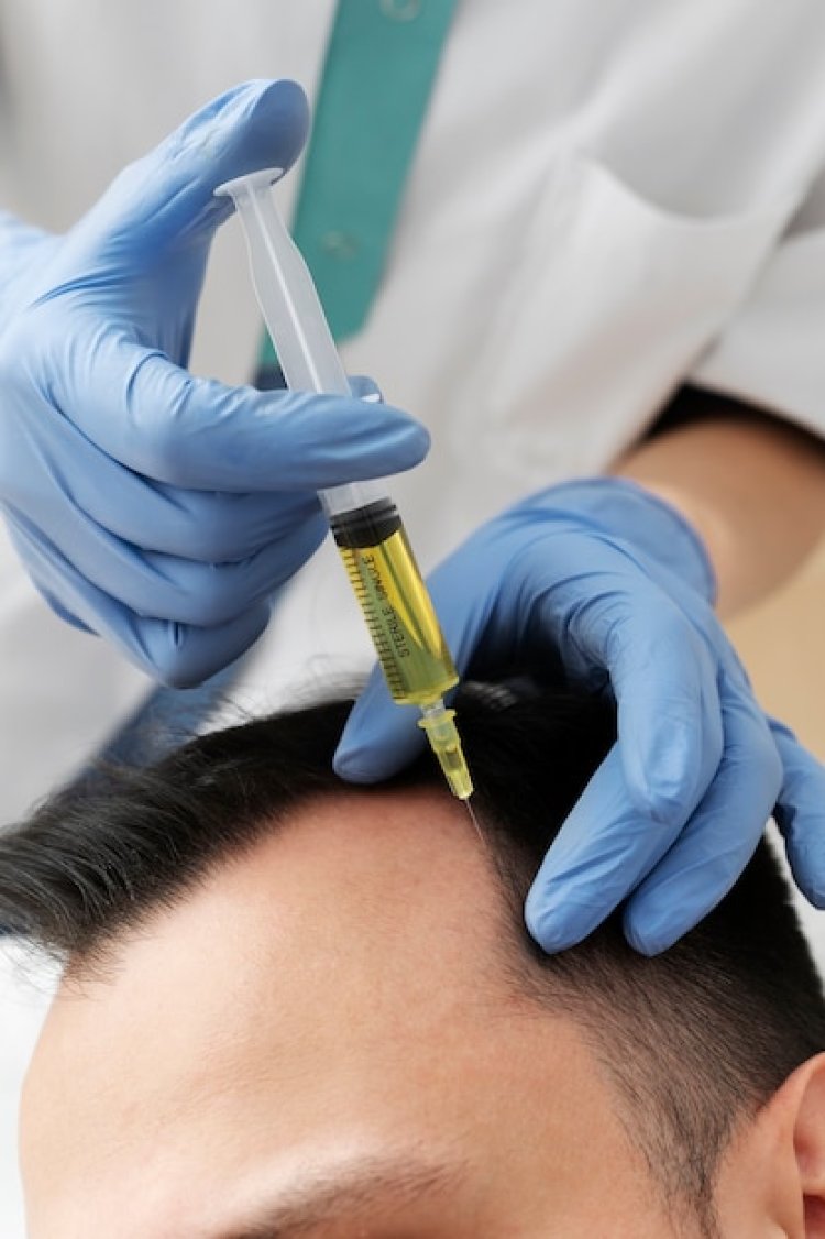 PRP Treatment: The Revolutionary Approach to Hair Restoration