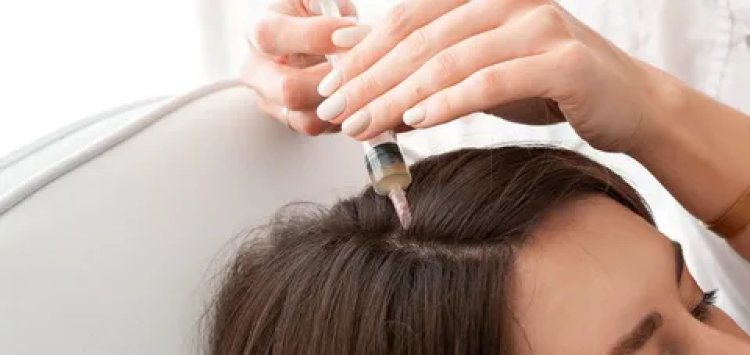 Addressing Hair Loss in Abu Dhabi with Plasma Injections