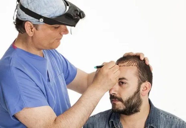 Hair Transplant in Riyadh: A Path to Restoring Confidence