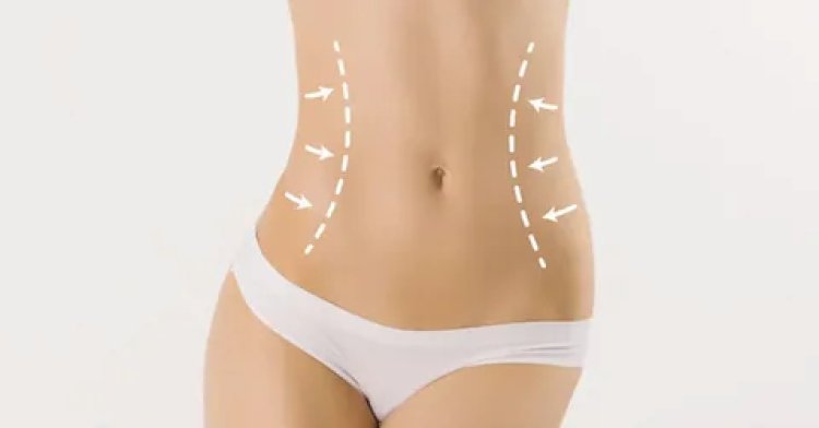 Liposuction Myths: Separating Fact from Fiction in Abu Dhabi