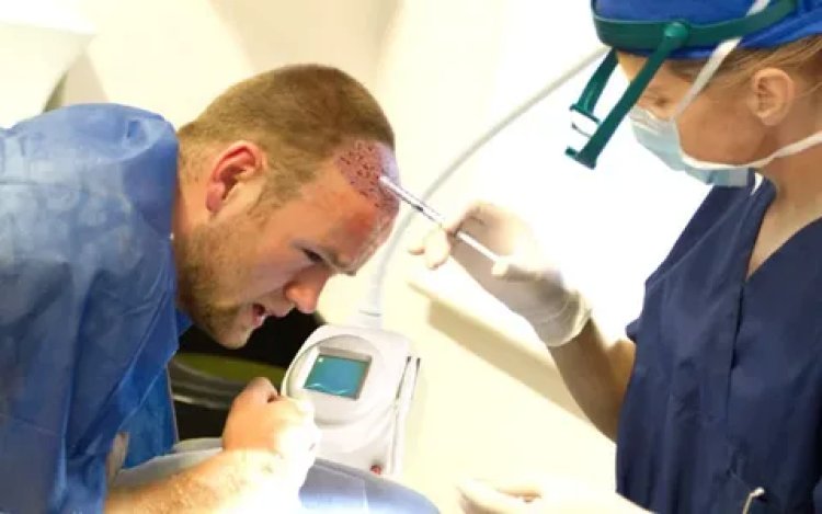 The Role of Technology in Hair Transplantation: A Look at Abu Dhabi Clinics