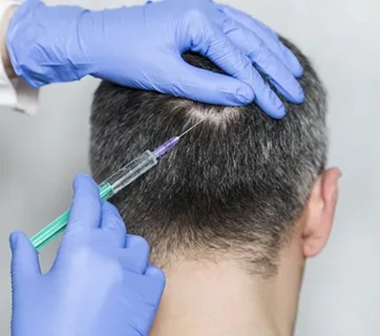 Understanding the Recovery Process After Plasma Hair Injections in Abu Dhabi