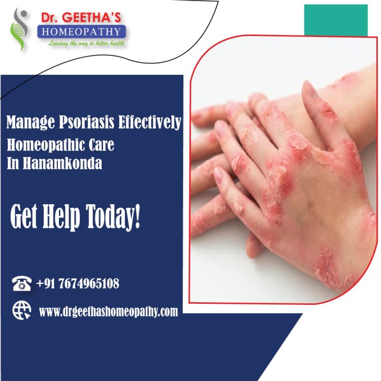 Effective Homeopathy Treatment for Psoriasis in Hanamkonda – Consult Dr. Geetha's Homeopathy