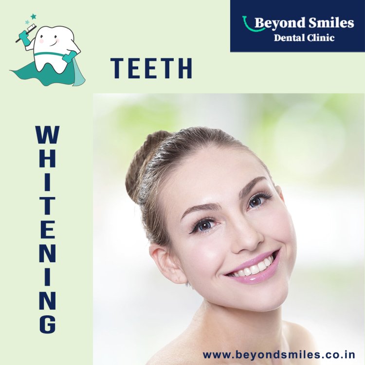 Simple And Effective Teeth Whitening Near Indiranagar