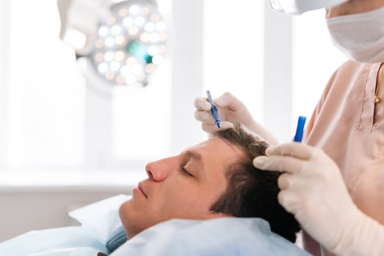 Exploring the Role of Lasers in Hair Transplantation in Abu Dhabi