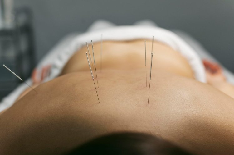 Integrating Acupuncture with Biomagnetic Therapy Techniques