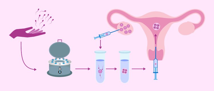 How to Choose the Right Fertility Centre: Key Factors to Consider?