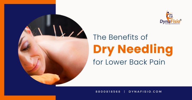 Exploring the Benefits of Dry Needling for Lower Back Pain