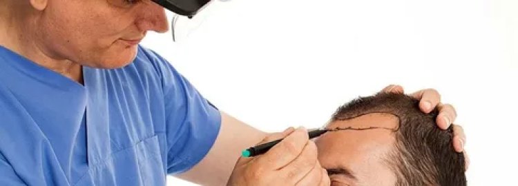 Hair Transplant Dubai The Secret to Natural Hair Regrowth