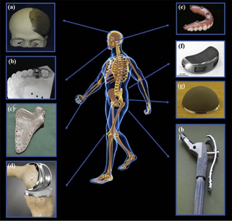 3D Printed Medical Implant Market To Power Robustly And To Witness Profitable Growth During The Forecast Period 2024-2030