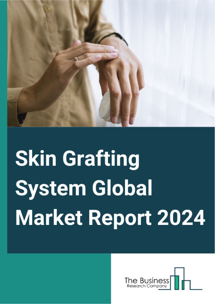 Skin Grafting System Global Market Outlook, Critical Insights, Trends Analysis, Key Players And Forecast To 2033