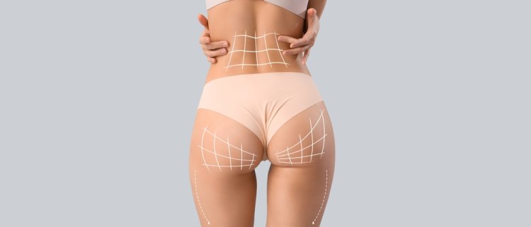 Why Choose Dubai for Your Brazilian Butt Lift Procedure?