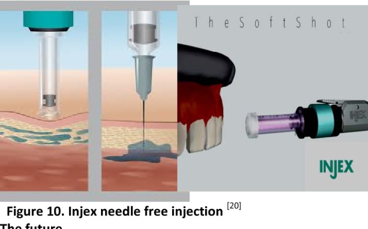 Global Needle Free Injection Market Size, In-Depth Assessment, CAGR, Demand, and Opportunity Analysis 2030 with Top Countries Data