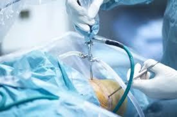 Dr. Shekhar Srivastav: Best Arthroscopy Surgeon in Delhi NCR for Advanced Joint Care