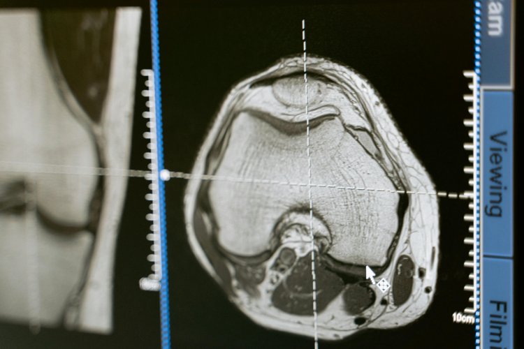 Vascular Imaging Devices Market : By Industry Trends, Leading Players, Size, Share, Growth, Opportunity And Forecast 2024-2033